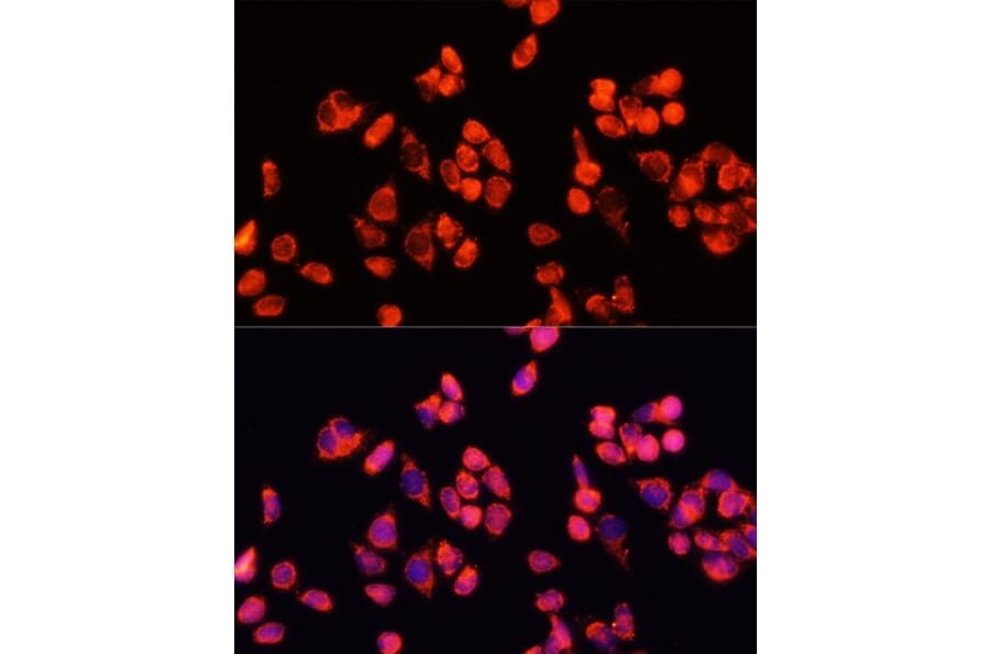 Immunofluorescence - Anti-Angiopoietin 2/ANG2 Antibody (A12691) - Antibodies.com