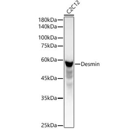 Western Blot - Anti-Desmin Antibody (A12692) - Antibodies.com