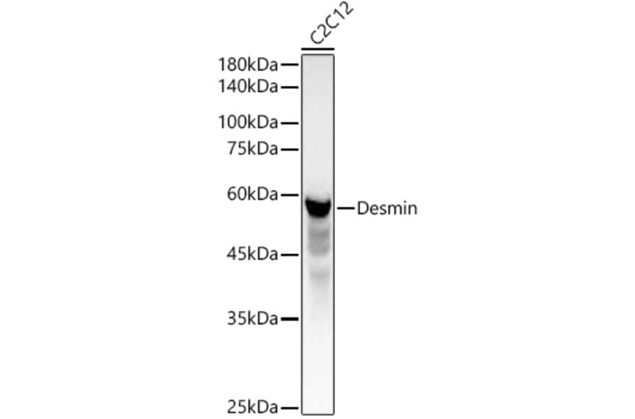 Western Blot - Anti-Desmin Antibody (A12692) - Antibodies.com