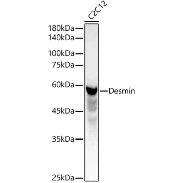 Western Blot - Anti-Desmin Antibody (A12692) - Antibodies.com