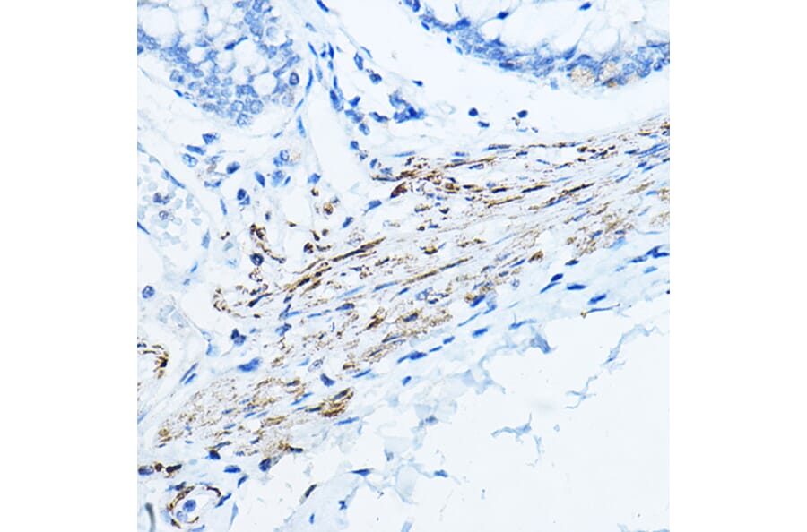 Immunohistochemistry - Anti-Desmin Antibody (A12692) - Antibodies.com
