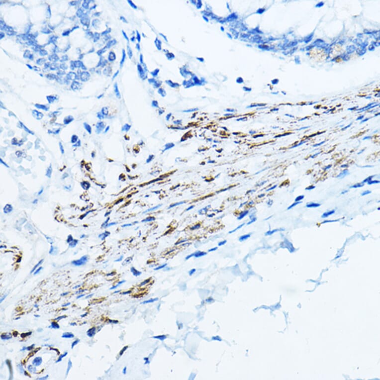 Immunohistochemistry - Anti-Desmin Antibody (A12692) - Antibodies.com
