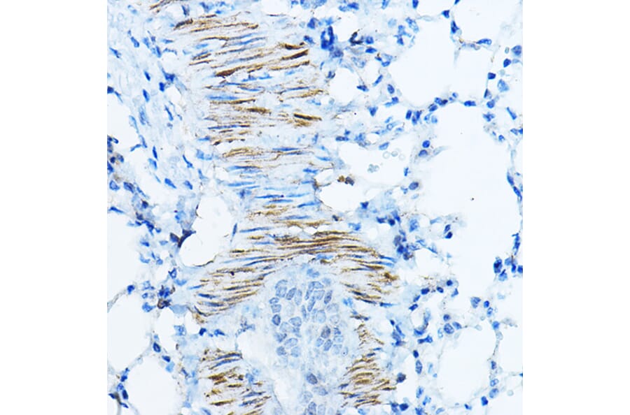 Immunohistochemistry - Anti-Desmin Antibody (A12692) - Antibodies.com