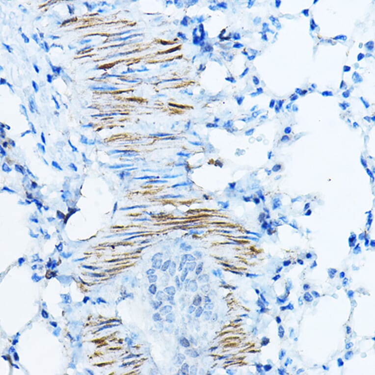 Immunohistochemistry - Anti-Desmin Antibody (A12692) - Antibodies.com