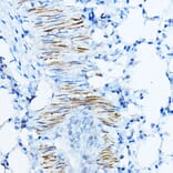 Immunohistochemistry - Anti-Desmin Antibody (A12692) - Antibodies.com
