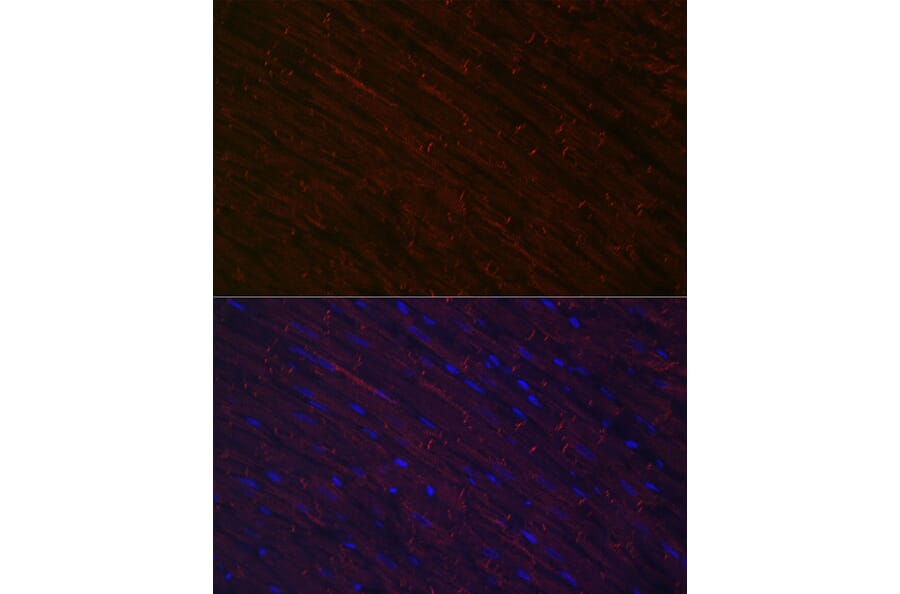 Immunofluorescence - Anti-Desmin Antibody (A12692) - Antibodies.com