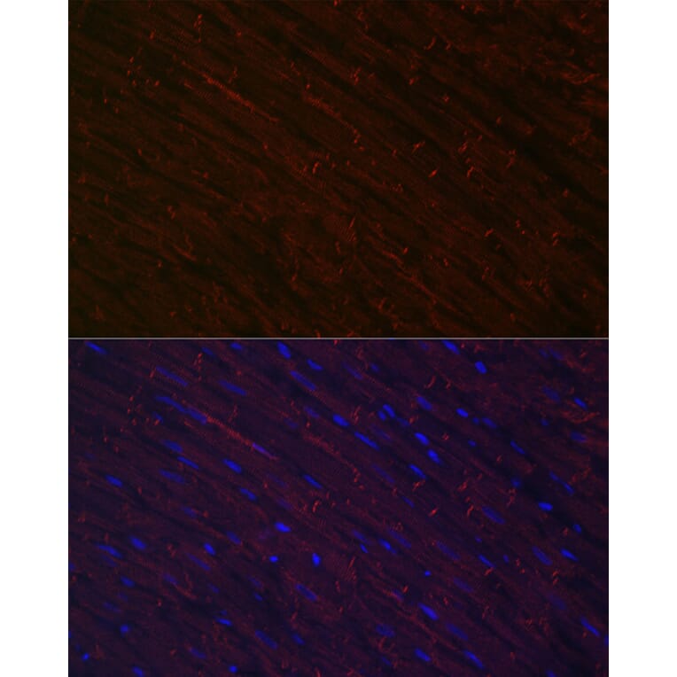 Immunofluorescence - Anti-Desmin Antibody (A12692) - Antibodies.com