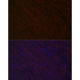 Immunofluorescence - Anti-Desmin Antibody (A12692) - Antibodies.com
