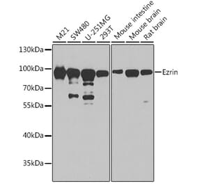 Western Blot - Anti-Ezrin Antibody (A12693) - Antibodies.com