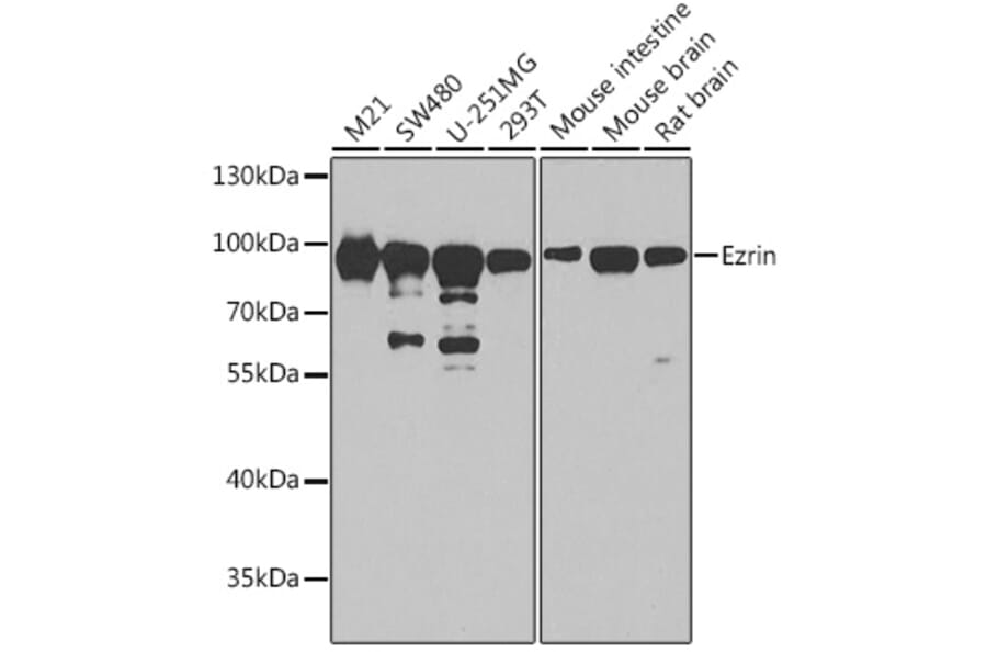 Western Blot - Anti-Ezrin Antibody (A12693) - Antibodies.com