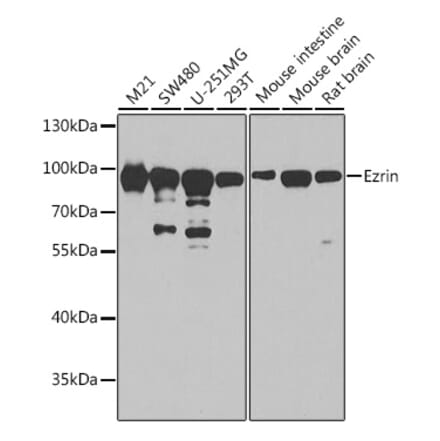 Western Blot - Anti-Ezrin Antibody (A12693) - Antibodies.com