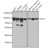 Western Blot - Anti-Ezrin Antibody (A12693) - Antibodies.com