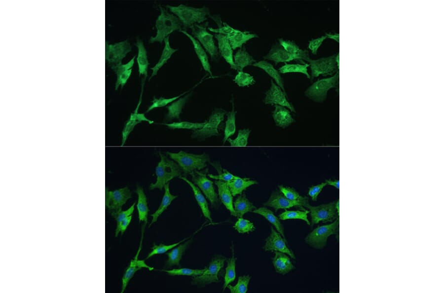 Immunofluorescence - Anti-Ezrin Antibody (A12693) - Antibodies.com