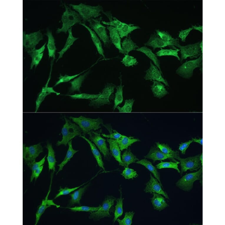 Immunofluorescence - Anti-Ezrin Antibody (A12693) - Antibodies.com