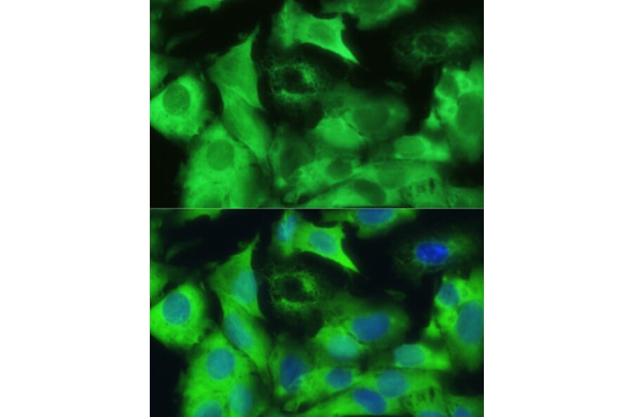 Immunofluorescence - Anti-Ezrin Antibody (A12693) - Antibodies.com