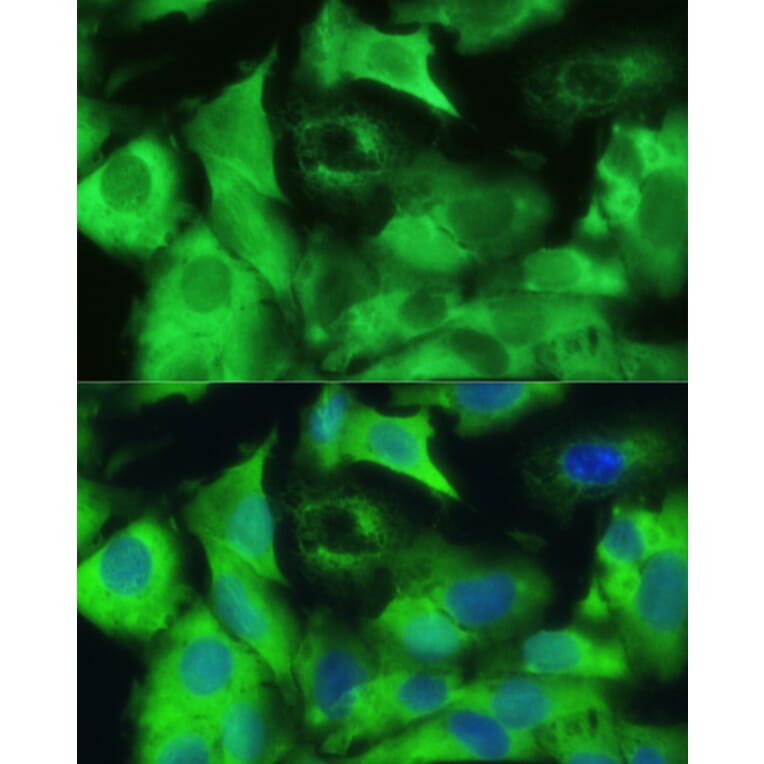 Immunofluorescence - Anti-Ezrin Antibody (A12693) - Antibodies.com