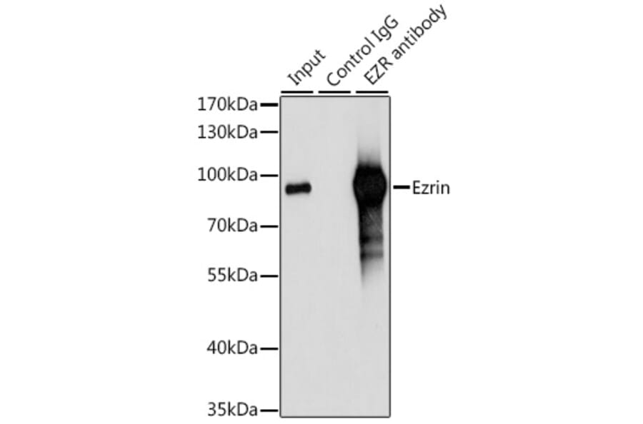 Western Blot - Anti-Ezrin Antibody (A12693) - Antibodies.com