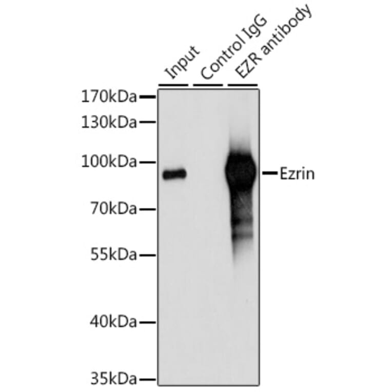 Western Blot - Anti-Ezrin Antibody (A12693) - Antibodies.com