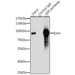 Western Blot - Anti-Ezrin Antibody (A12693) - Antibodies.com