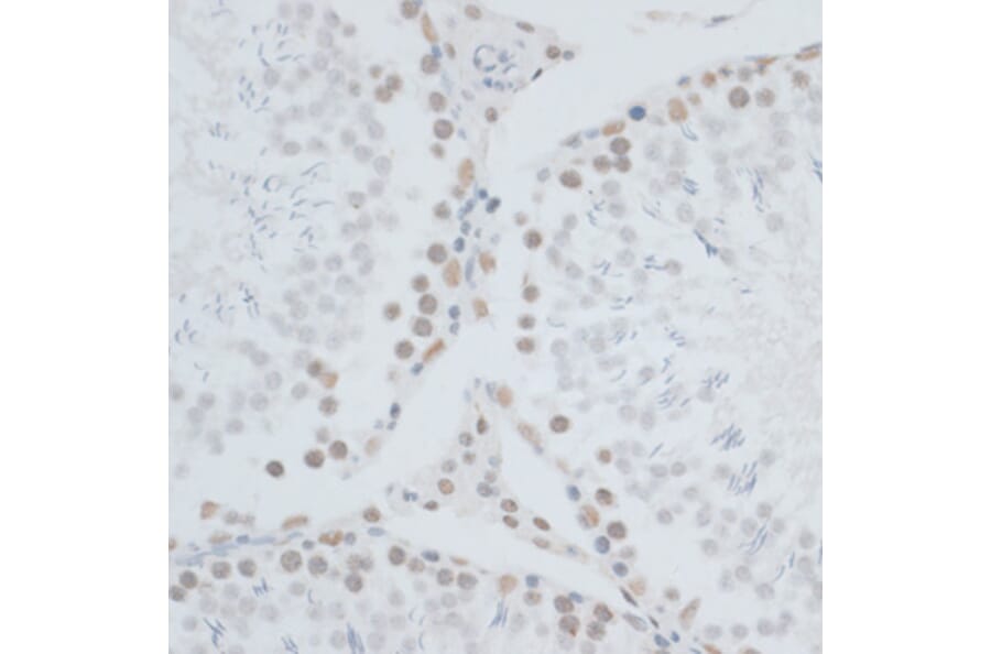 Immunohistochemistry - Anti-HMGB1 Antibody (A0719) - Antibodies.com