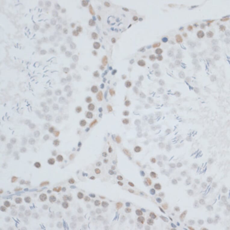 Immunohistochemistry - Anti-HMGB1 Antibody (A0719) - Antibodies.com