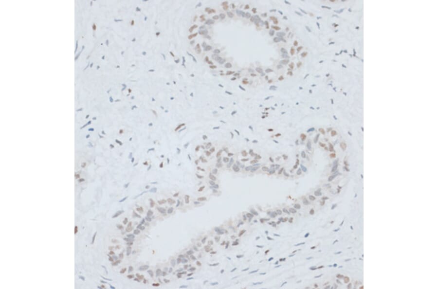 Immunohistochemistry - Anti-HMGB1 Antibody (A0719) - Antibodies.com