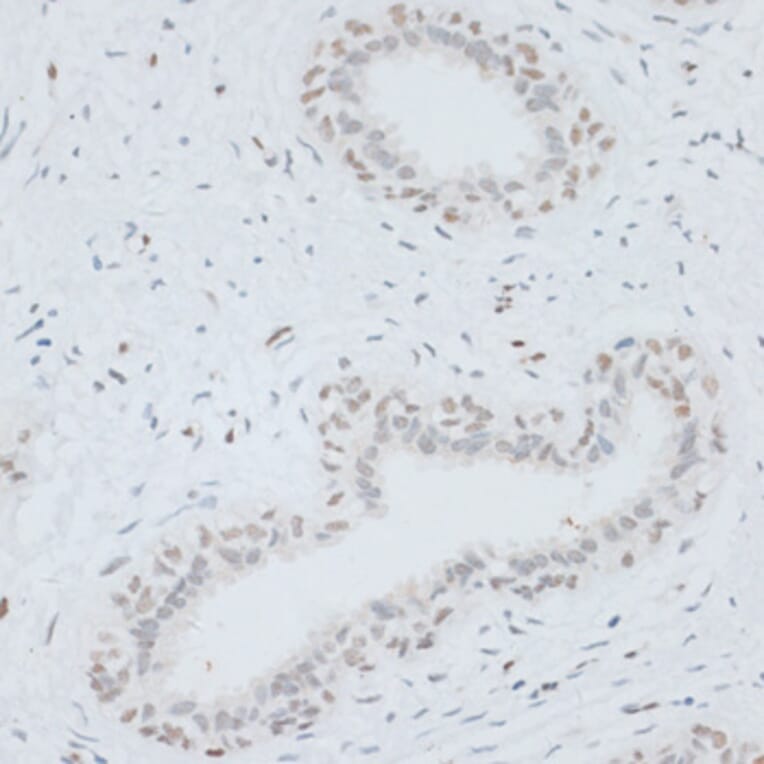 Immunohistochemistry - Anti-HMGB1 Antibody (A0719) - Antibodies.com