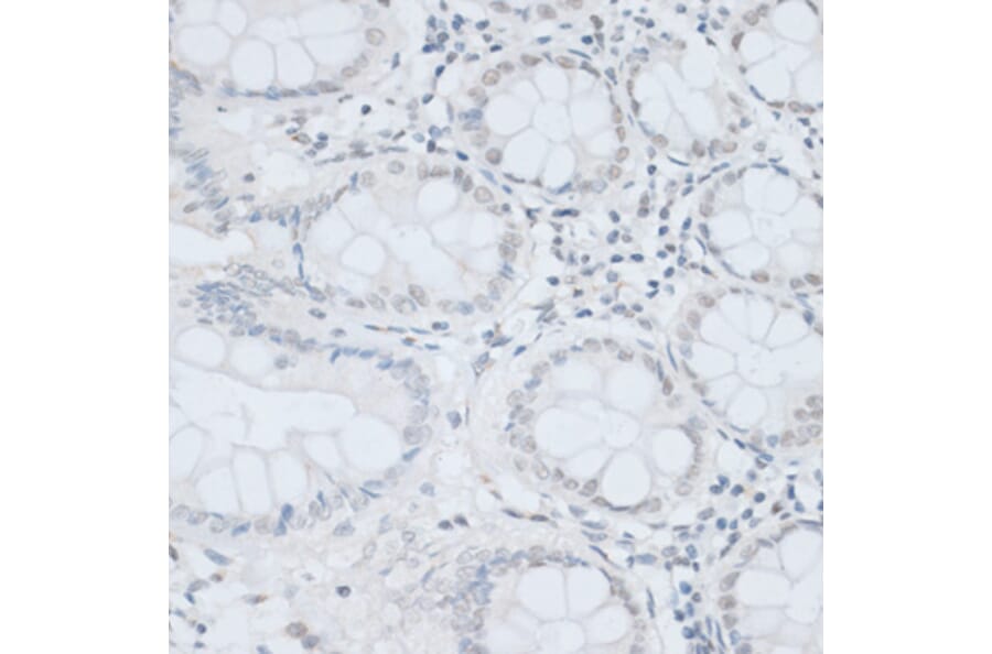Immunohistochemistry - Anti-HMGB1 Antibody (A0719) - Antibodies.com