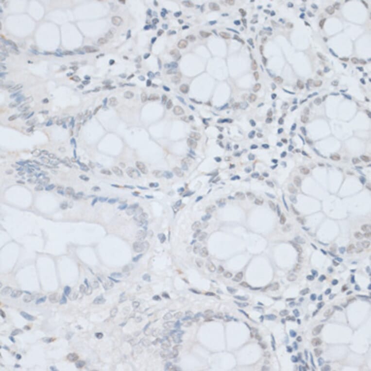 Immunohistochemistry - Anti-HMGB1 Antibody (A0719) - Antibodies.com