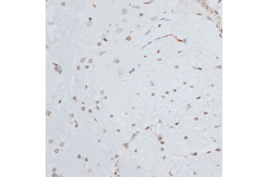 Immunohistochemistry - Anti-HMGB1 Antibody (A0719) - Antibodies.com