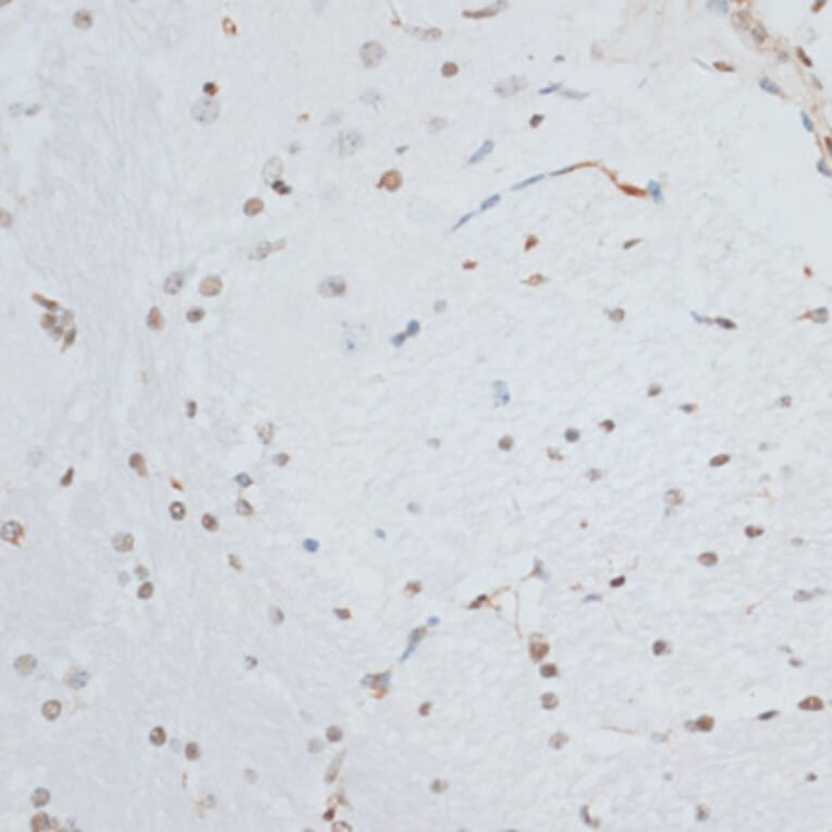 Immunohistochemistry - Anti-HMGB1 Antibody (A0719) - Antibodies.com