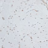 Immunohistochemistry - Anti-HMGB1 Antibody (A0719) - Antibodies.com