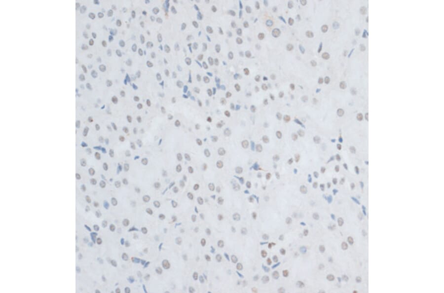 Immunohistochemistry - Anti-HMGB1 Antibody (A0719) - Antibodies.com