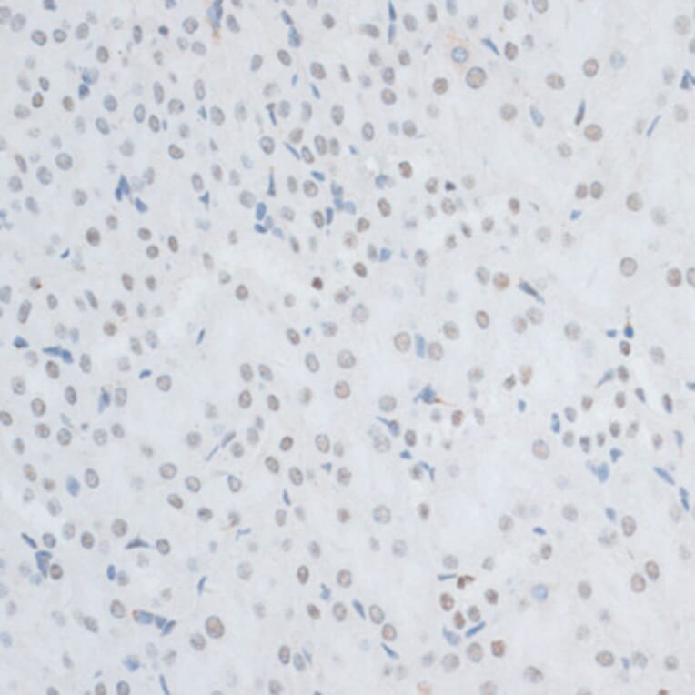 Immunohistochemistry - Anti-HMGB1 Antibody (A0719) - Antibodies.com