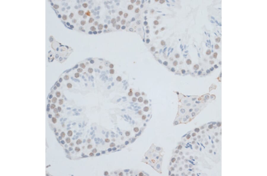 Immunohistochemistry - Anti-HMGB1 Antibody (A0719) - Antibodies.com