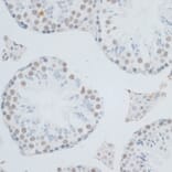 Immunohistochemistry - Anti-HMGB1 Antibody (A0719) - Antibodies.com