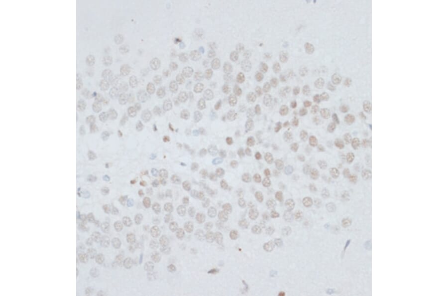 Immunohistochemistry - Anti-HMGB1 Antibody (A0719) - Antibodies.com