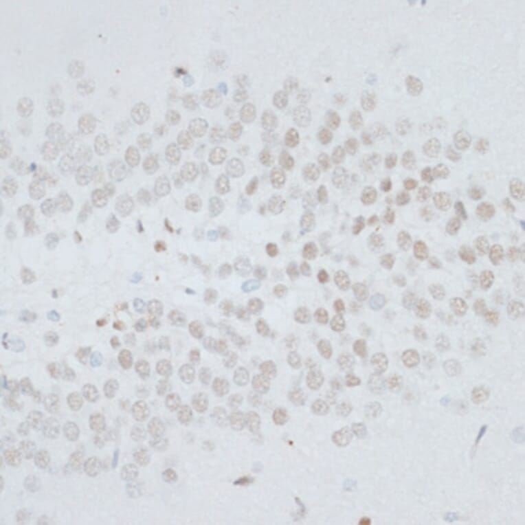 Immunohistochemistry - Anti-HMGB1 Antibody (A0719) - Antibodies.com