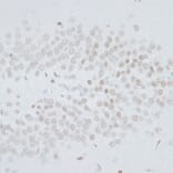 Immunohistochemistry - Anti-HMGB1 Antibody (A0719) - Antibodies.com