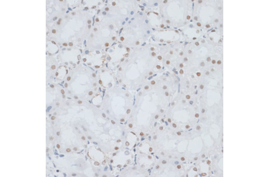 Immunohistochemistry - Anti-HMGB1 Antibody (A0719) - Antibodies.com