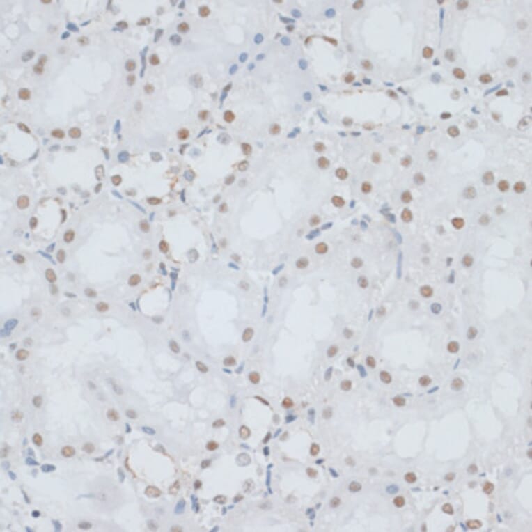 Immunohistochemistry - Anti-HMGB1 Antibody (A0719) - Antibodies.com