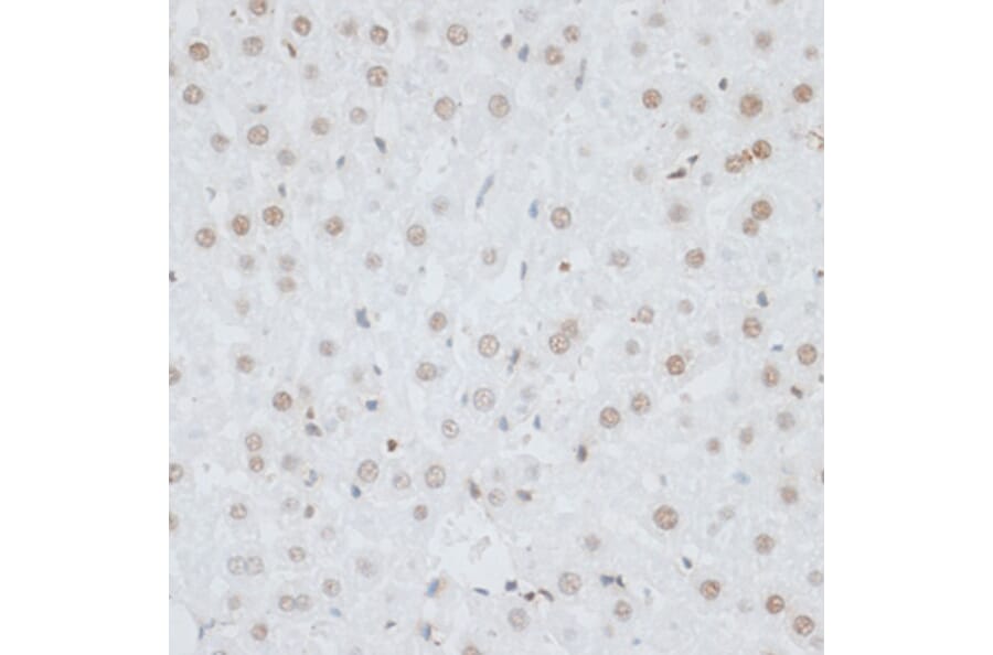Immunohistochemistry - Anti-HMGB1 Antibody (A0719) - Antibodies.com