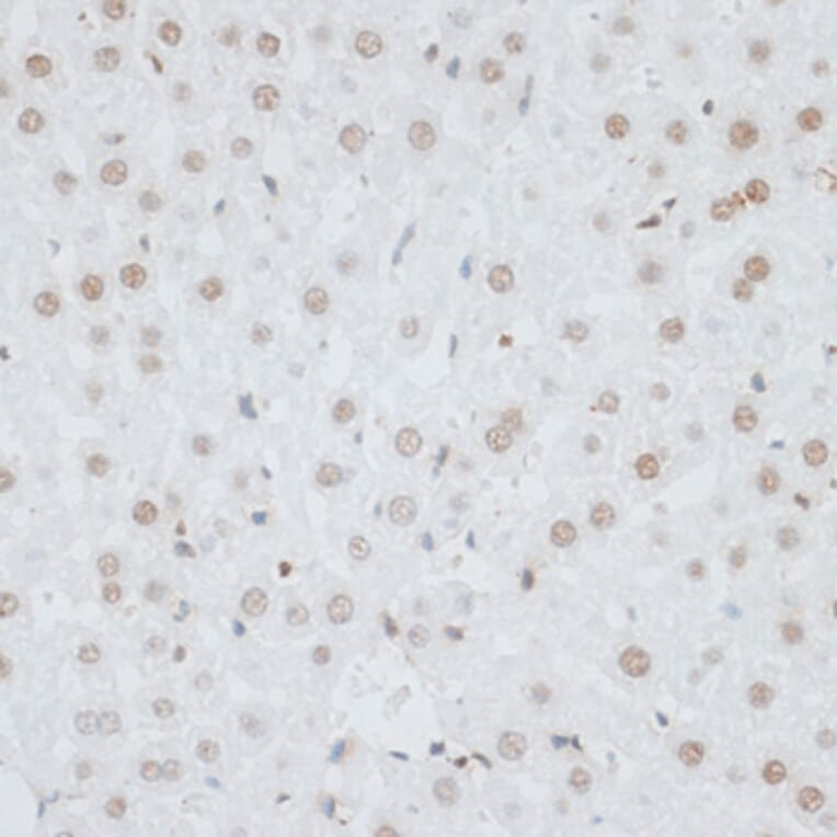 Immunohistochemistry - Anti-HMGB1 Antibody (A0719) - Antibodies.com