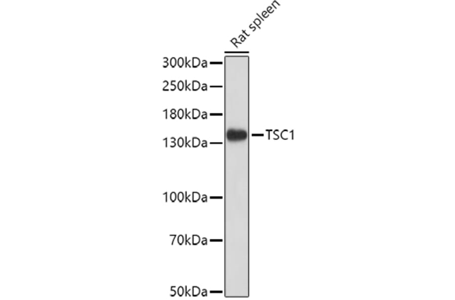 Western Blot - Anti-Hamartin Antibody (A12695) - Antibodies.com