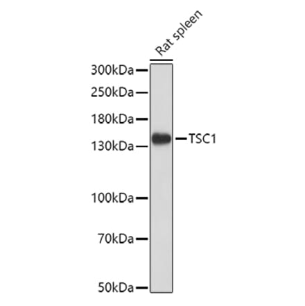Western Blot - Anti-Hamartin Antibody (A12695) - Antibodies.com