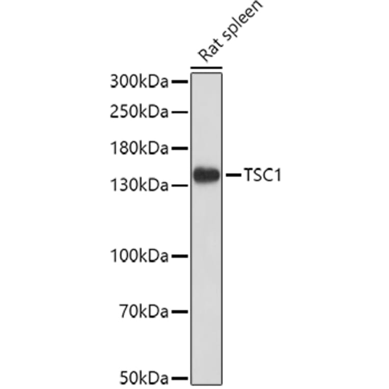 Western Blot - Anti-Hamartin Antibody (A12695) - Antibodies.com