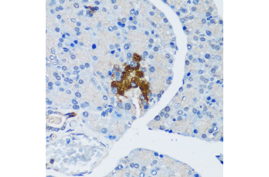 Immunohistochemistry - Anti-Hamartin Antibody (A12695) - Antibodies.com