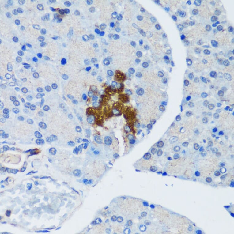 Immunohistochemistry - Anti-Hamartin Antibody (A12695) - Antibodies.com
