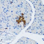 Immunohistochemistry - Anti-Hamartin Antibody (A12695) - Antibodies.com