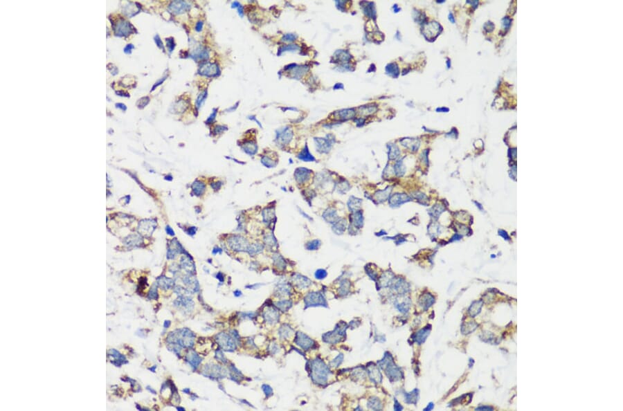 Immunohistochemistry - Anti-Hamartin Antibody (A12695) - Antibodies.com